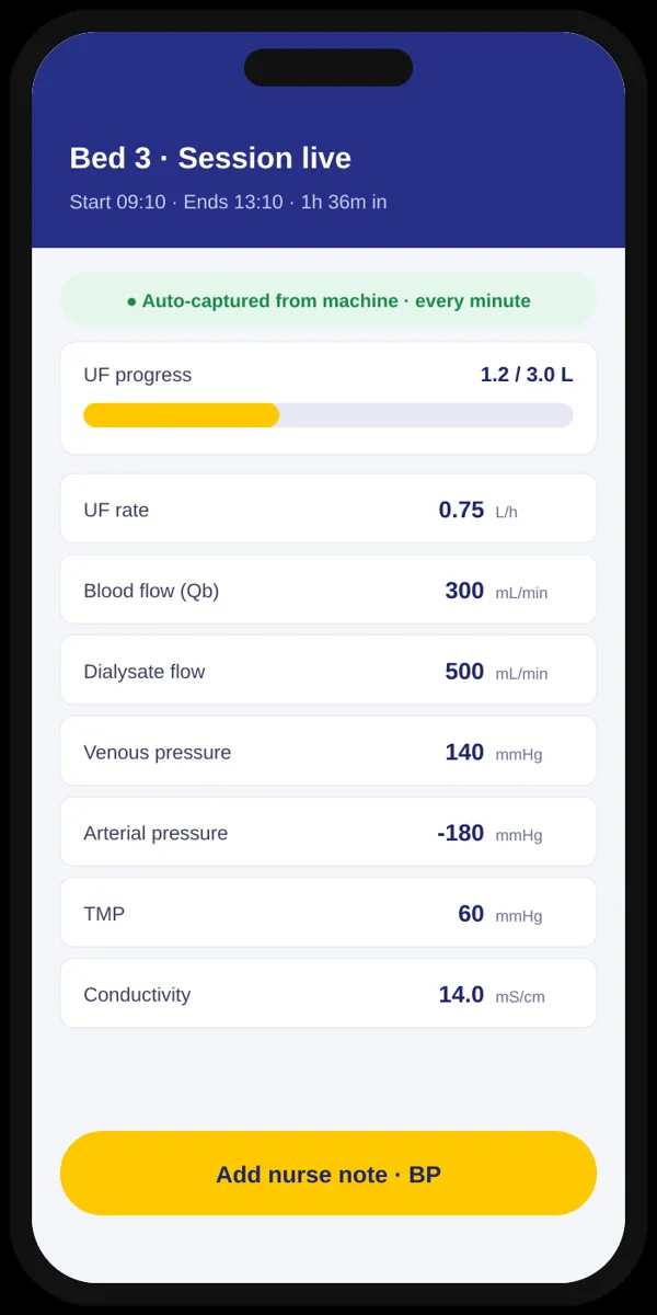 Live dialysis session on a phone
