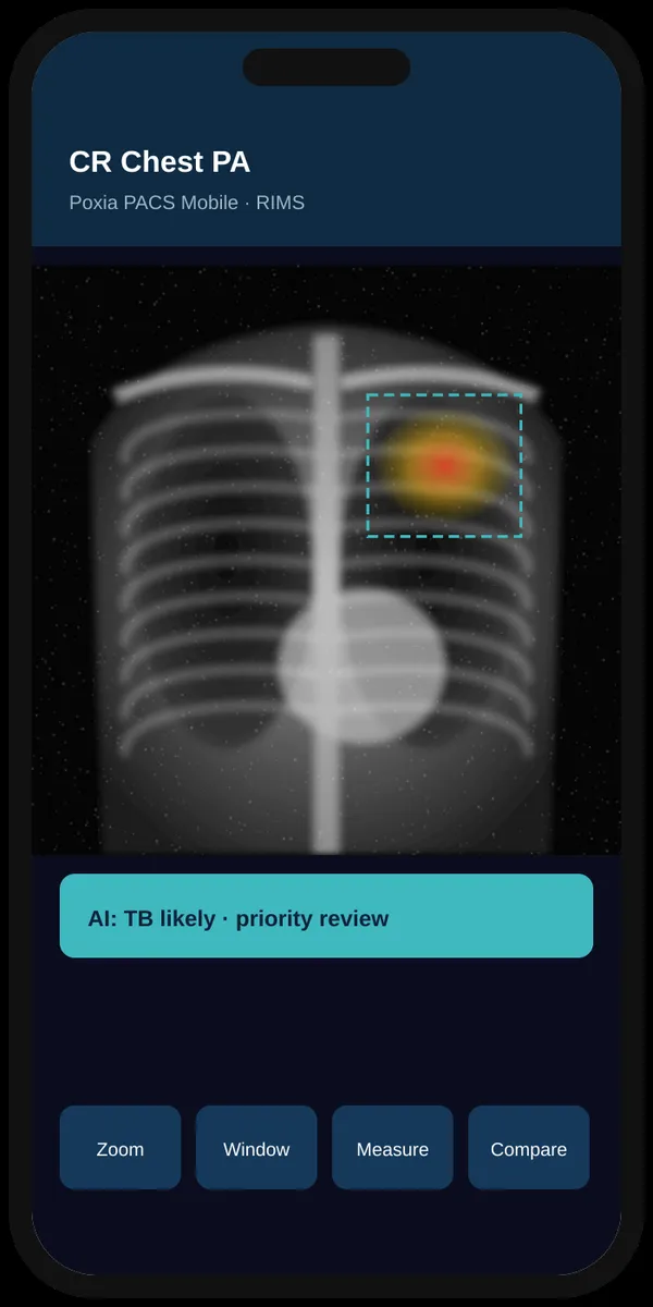 Chest X-ray on the PACS app